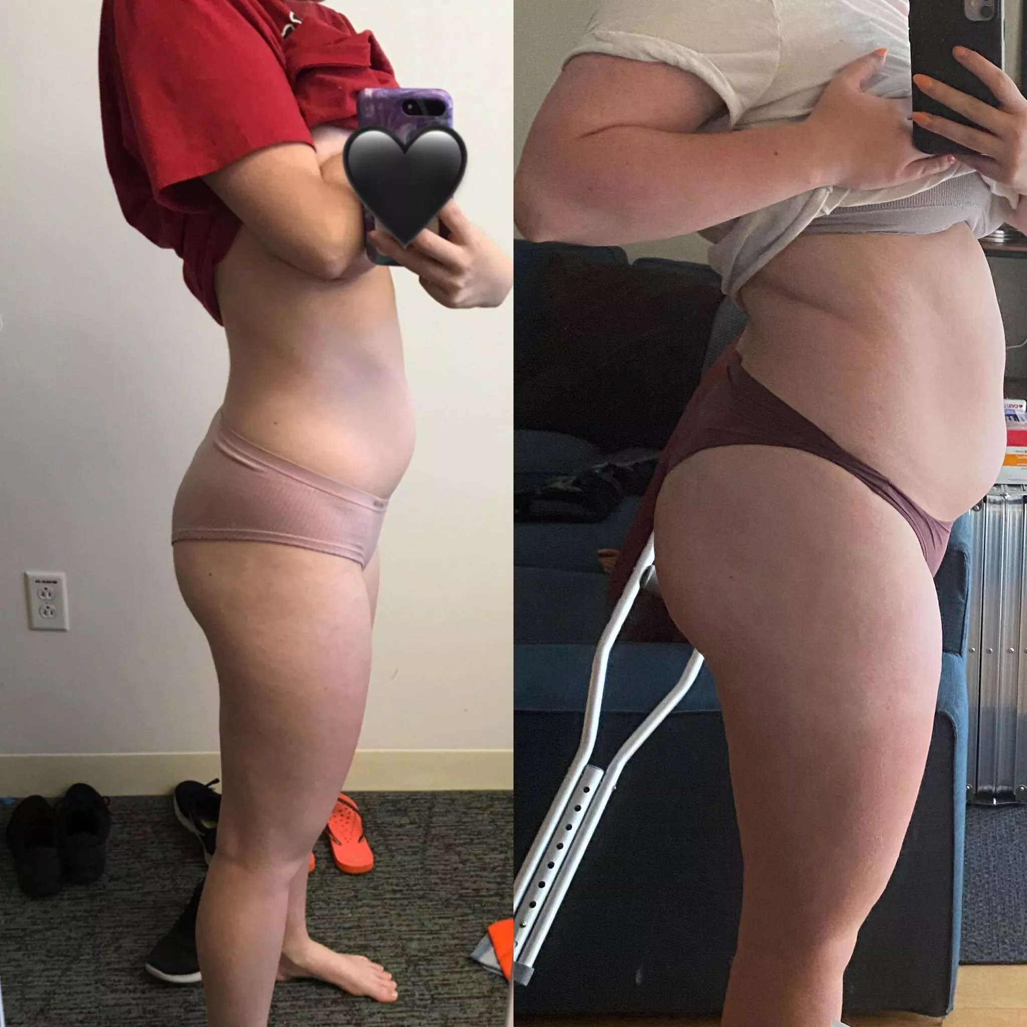 It’s not that noticeable, right? 🤫