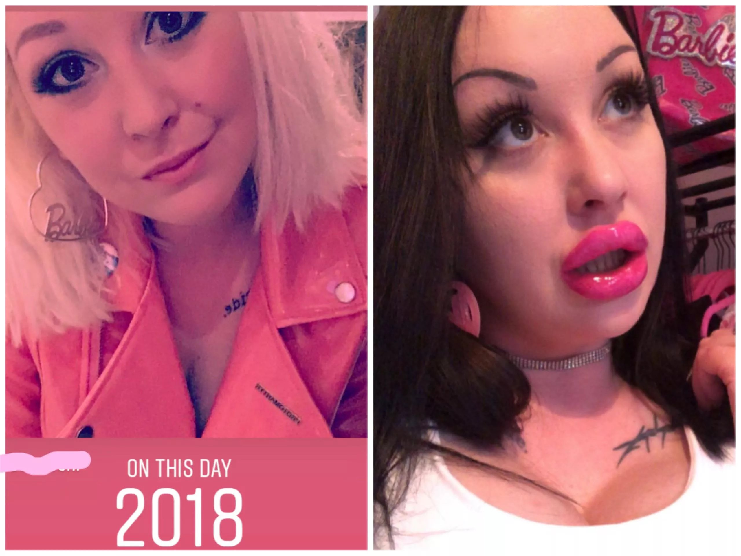 Thank f💗ck for fillers!