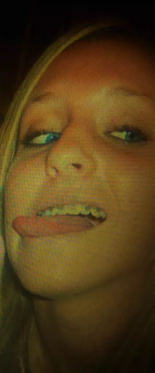 Tongue and Braces.