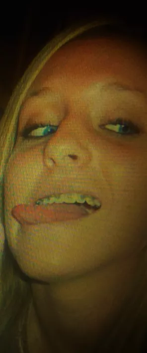 Tongue and Braces. Tongue and Braces.