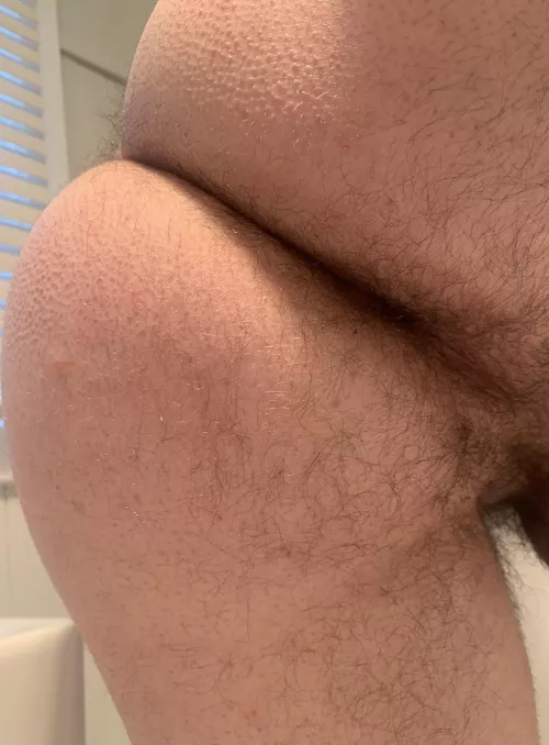 Hairy hole