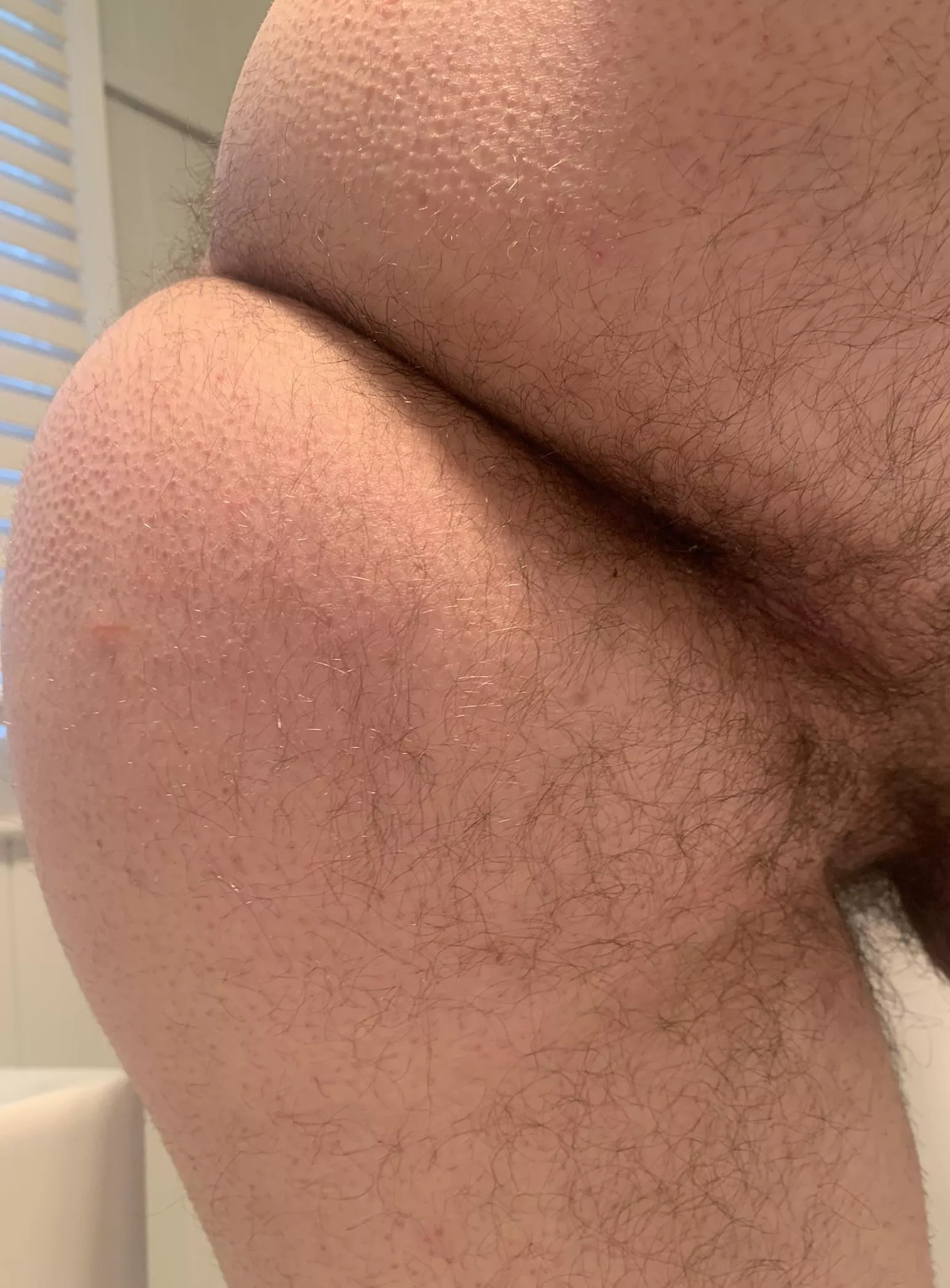 Hairy hole