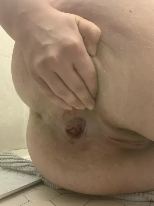 Am I ready for a fist?