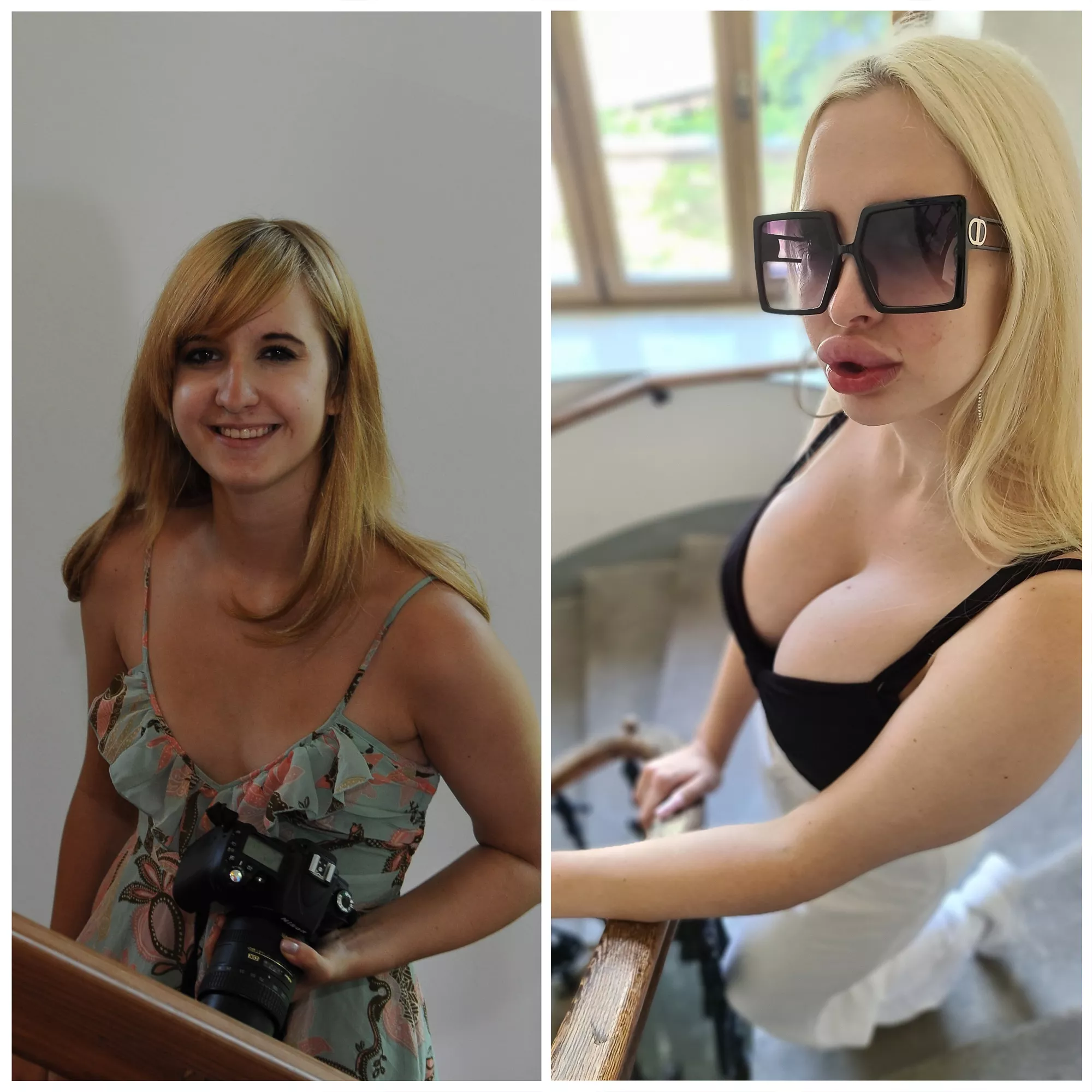 Before and after 1050cc implants. Should I keep expanding?