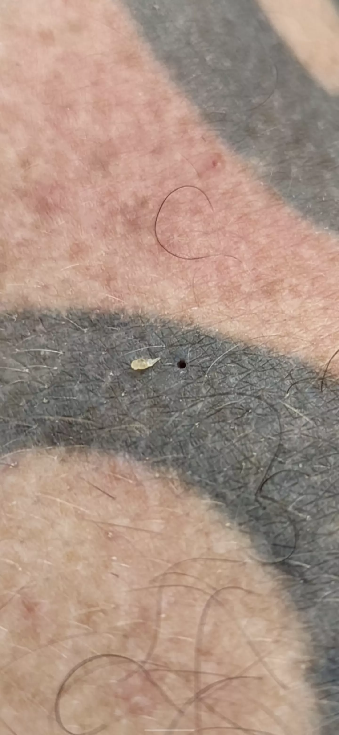 my partner gets these gnarly boys on his back, sooooo satisfying