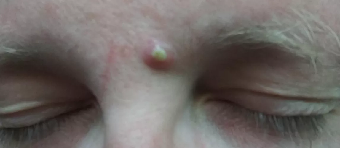 Nothing like a screaming yellow honker to make you feel young again.