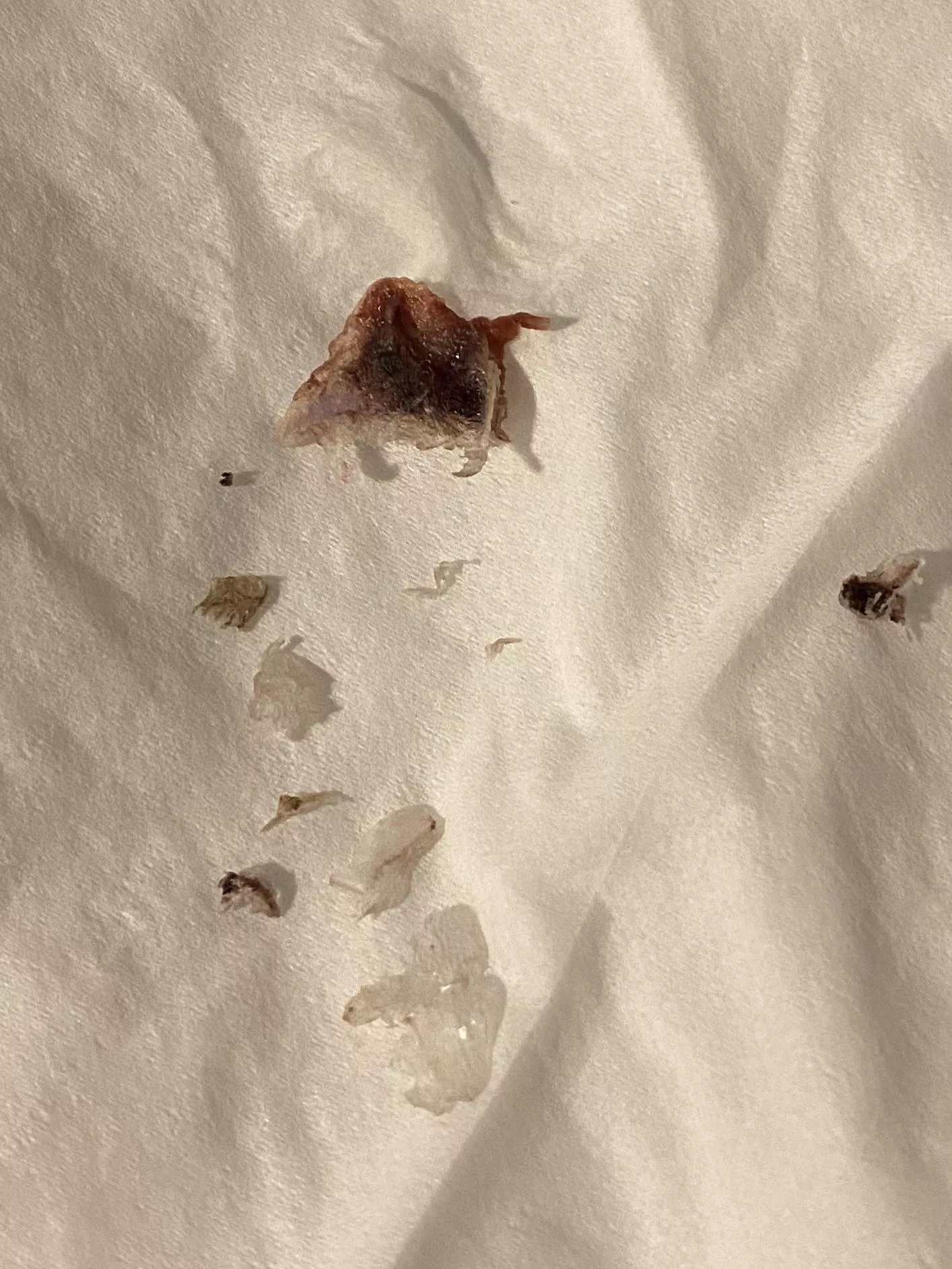 A scab I pulled out of my belly button after hysterectomy