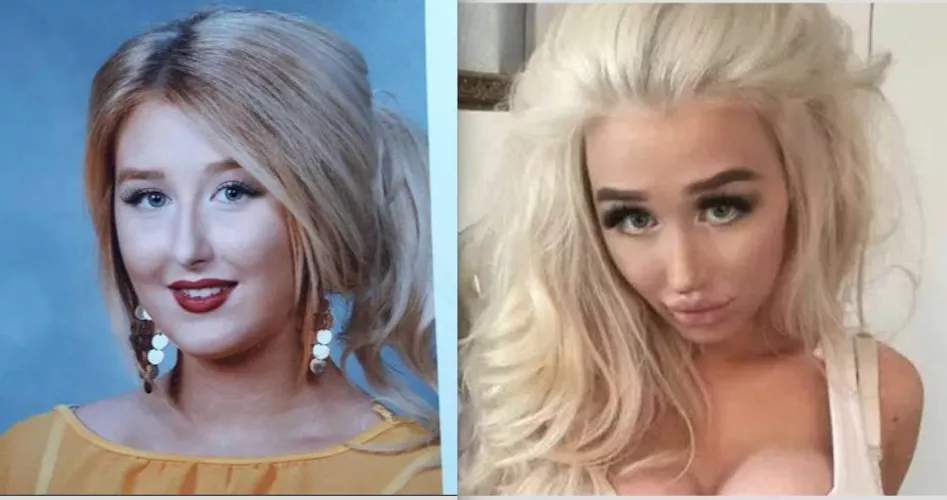 Before and After - Yearbook photo to current state bimbo