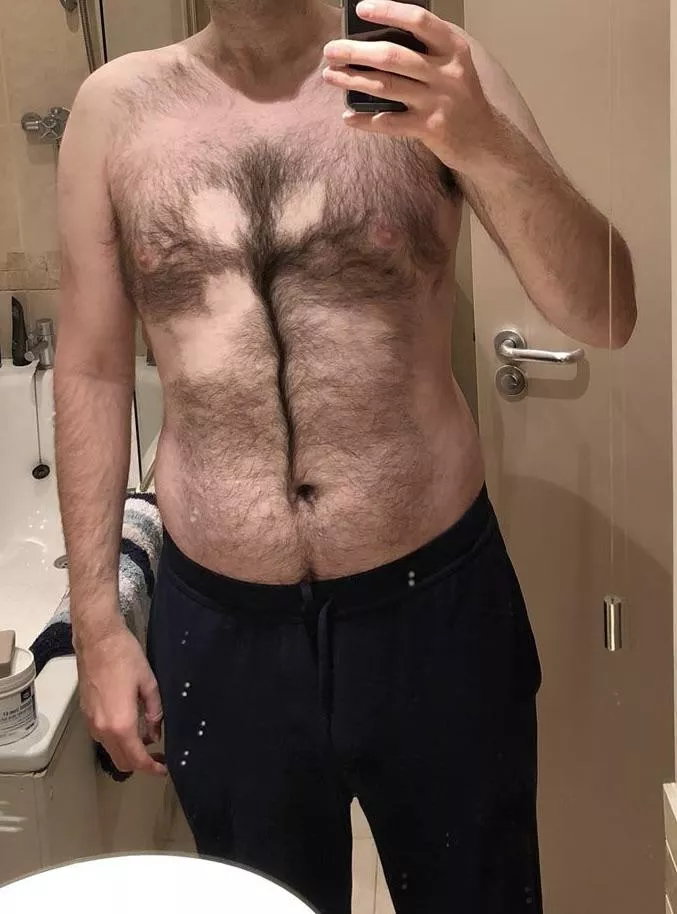 I had an ECG today and look what they’ve done to my chest! How long until it grows back?!?