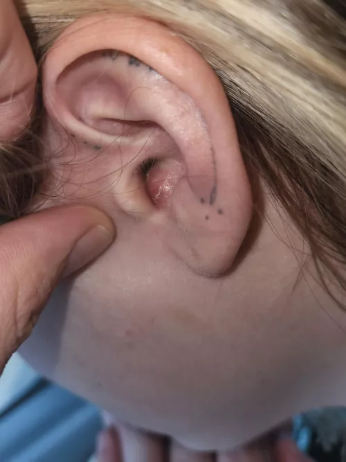 a place that popped up a couple days ago. Hurts so bad, anybody else ever have this happen?