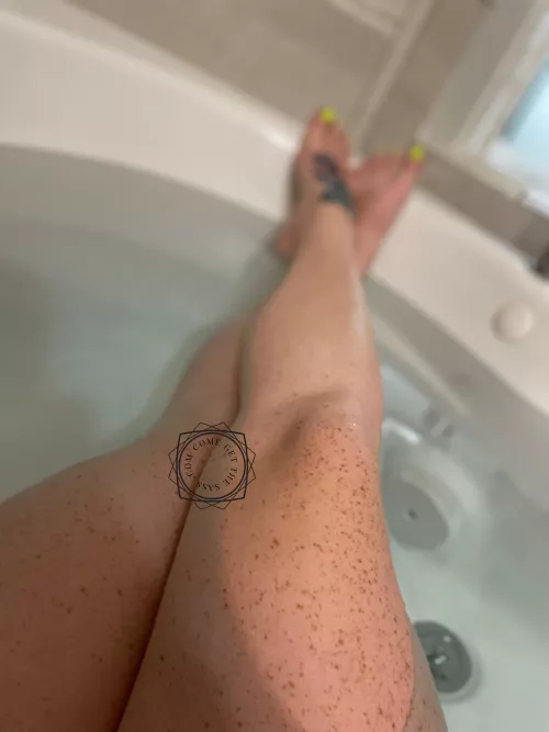 Who’s all for freckles?