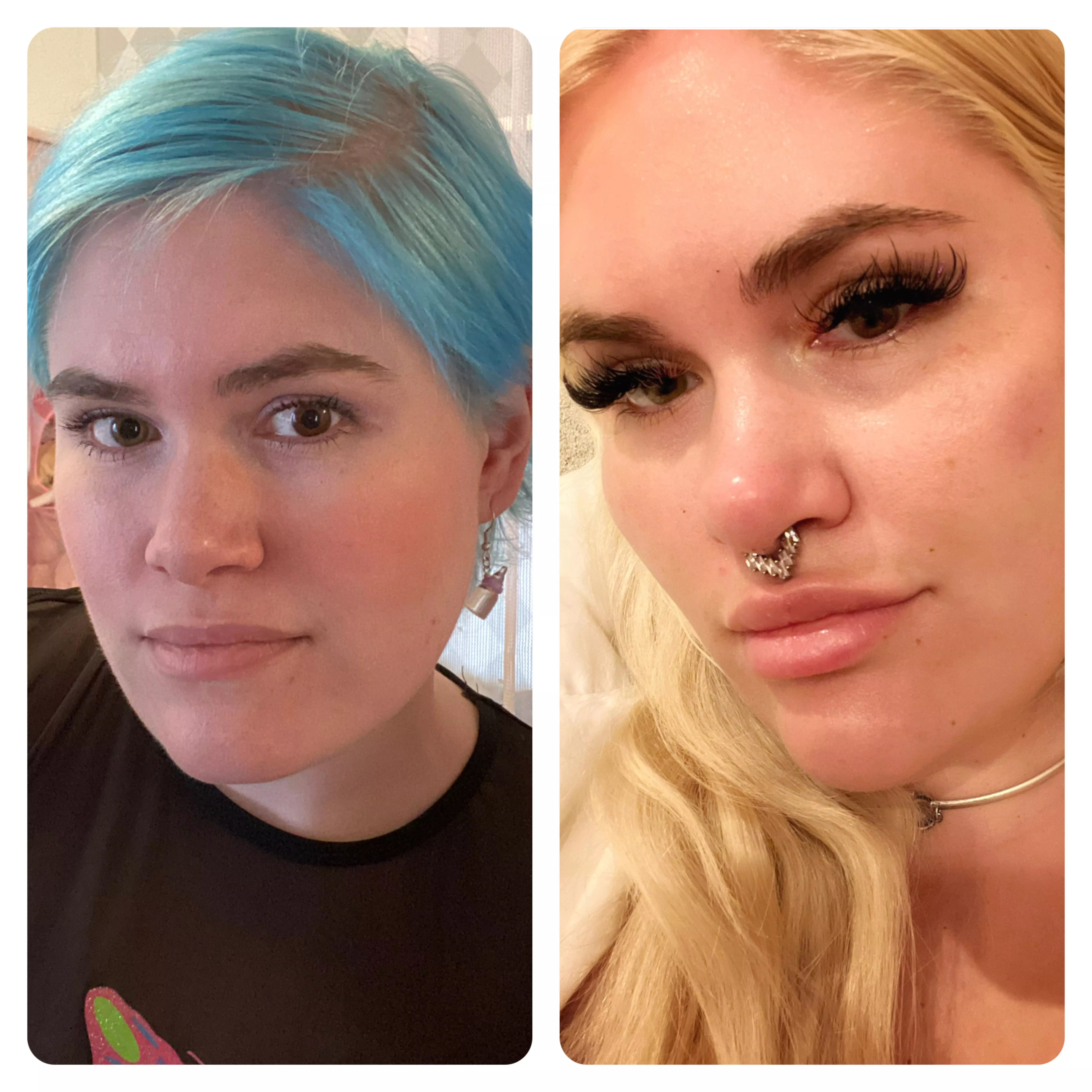 How my face has changed (no makeup-version) How my face has changed (no makeup-version)