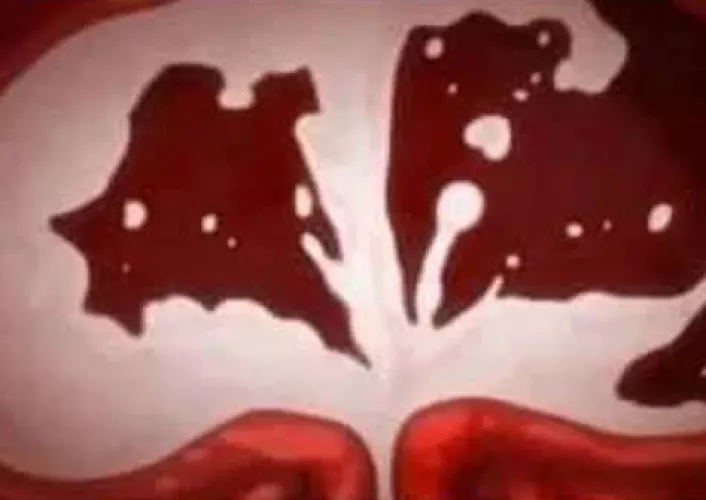 LF Color Source: close up, creampie, internal cumshot, meme, uncensored, womb/uterus, x-ray