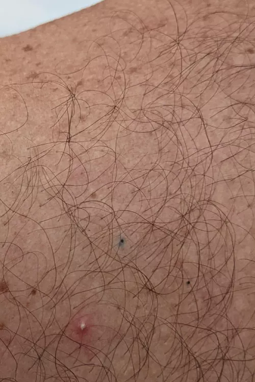 Out on the boat with my parents and husband... my dad's back is covered in stuff like this and he refuses to let anybody touch it 🙃😒