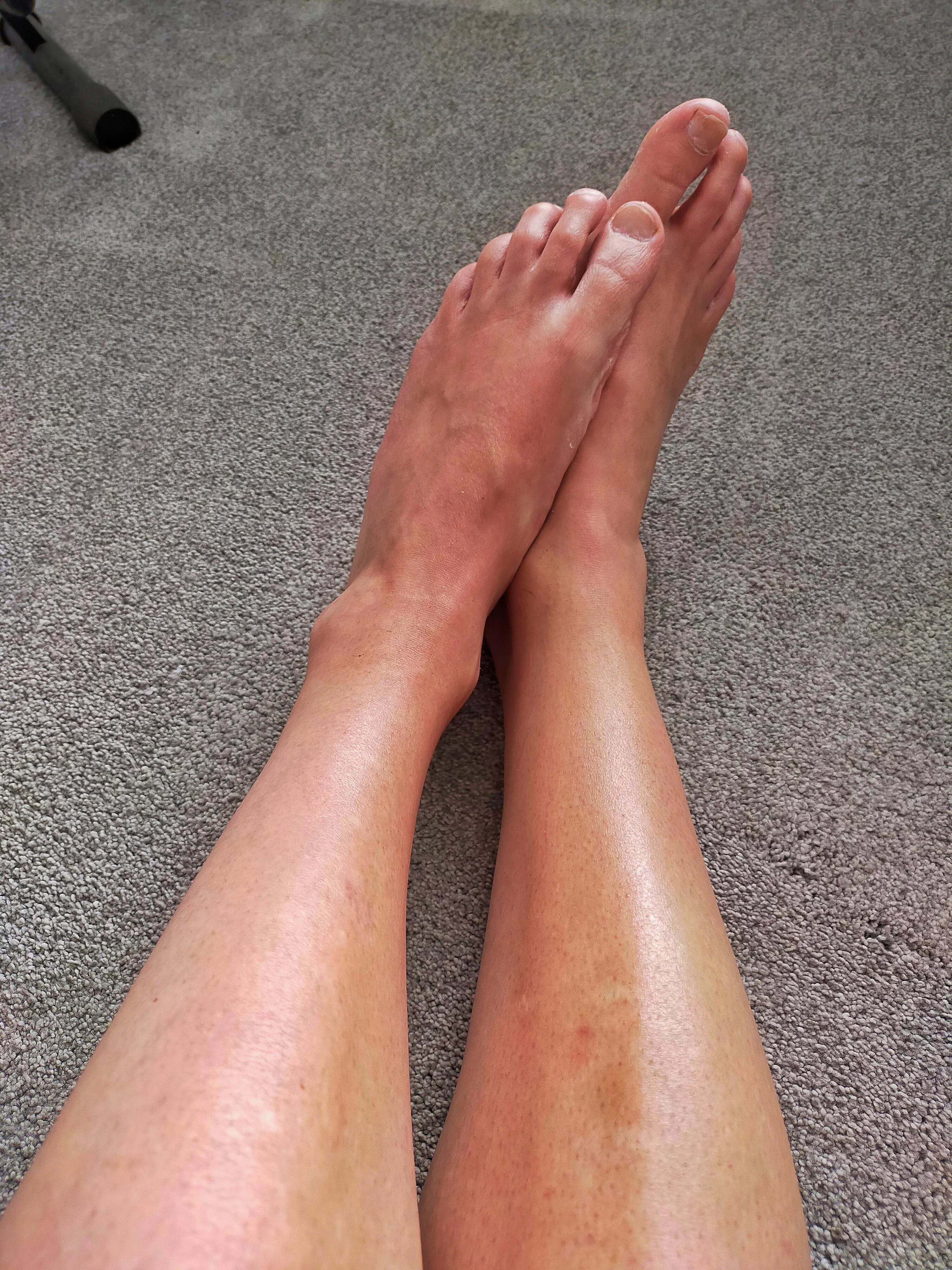 I love having smooth feet 🥰