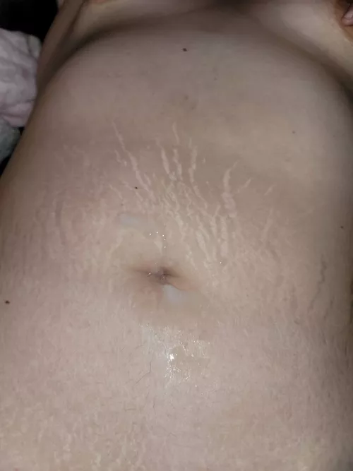Tiger stripes and cum in my belly button.. I love this pic of my tummy 😍