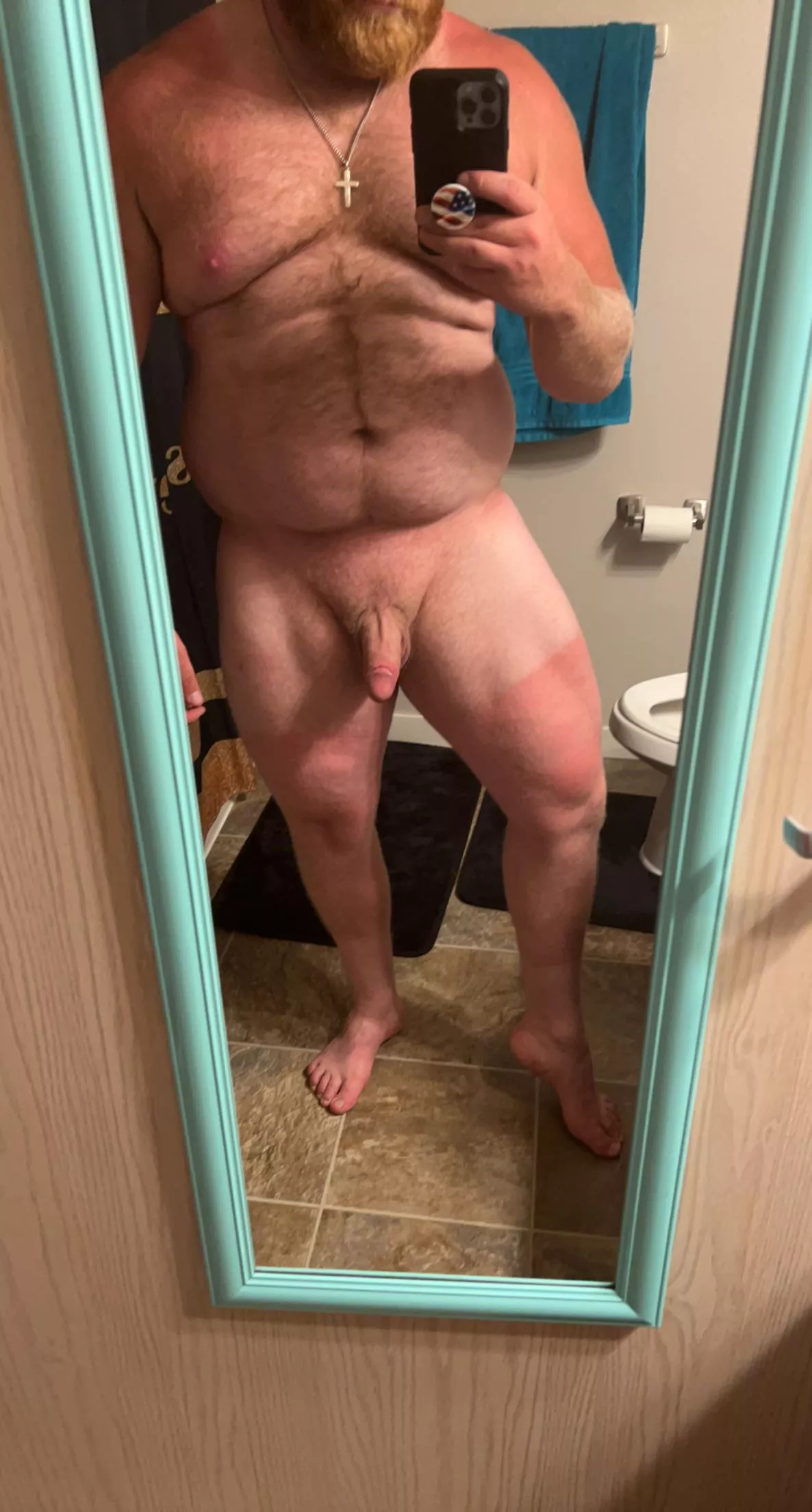 I think I burnt my legs at work today😅