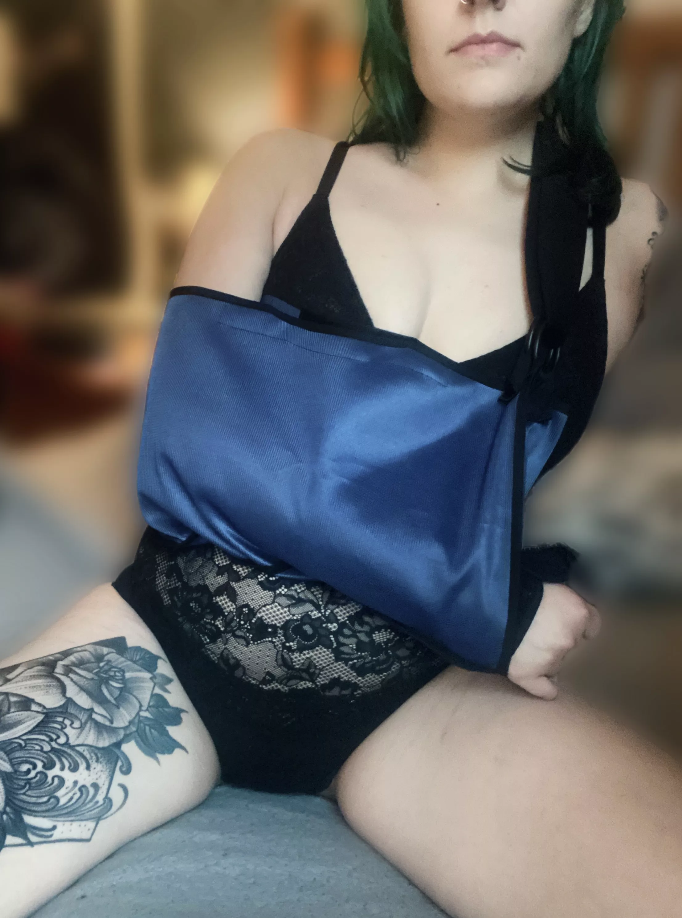 Don't mind the broken wrist…? 👉 👈