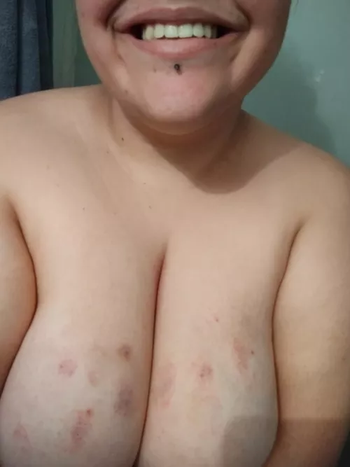 hickies are always fun 😉