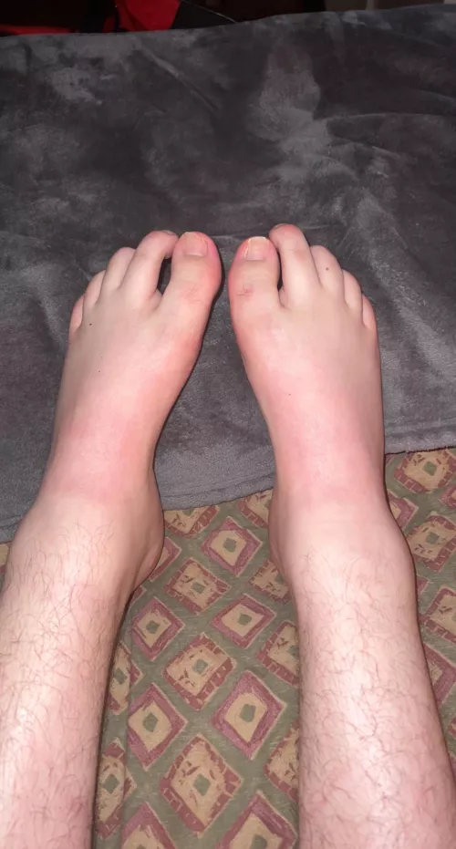 Come worshipp these beautiful unique feet boys ;)