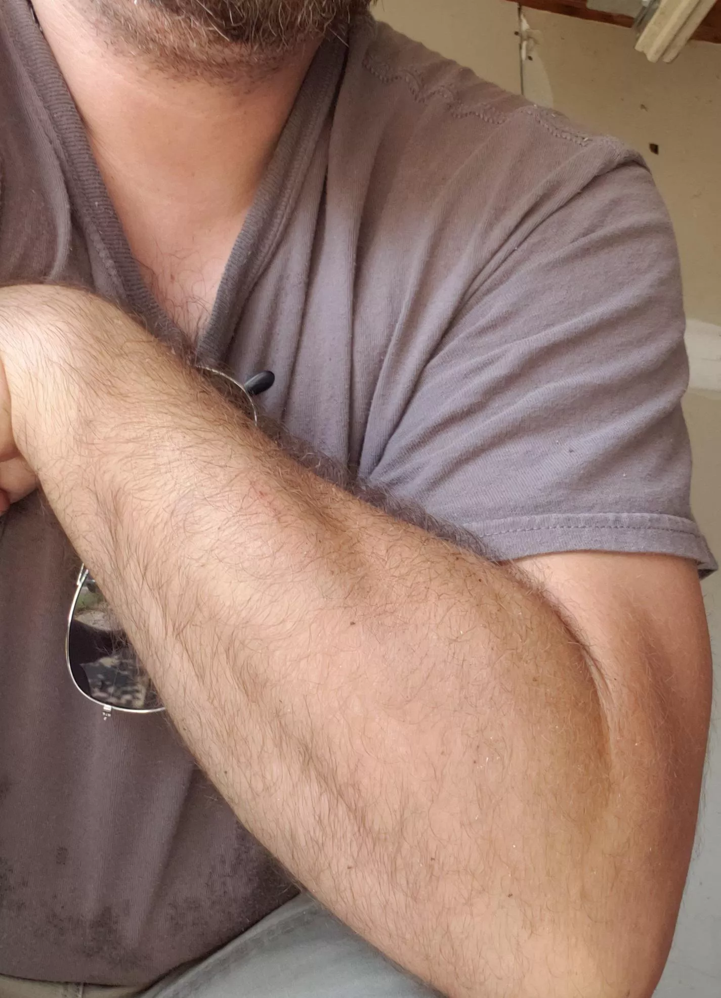 odd, I don't remember getting a scratch on my arm...