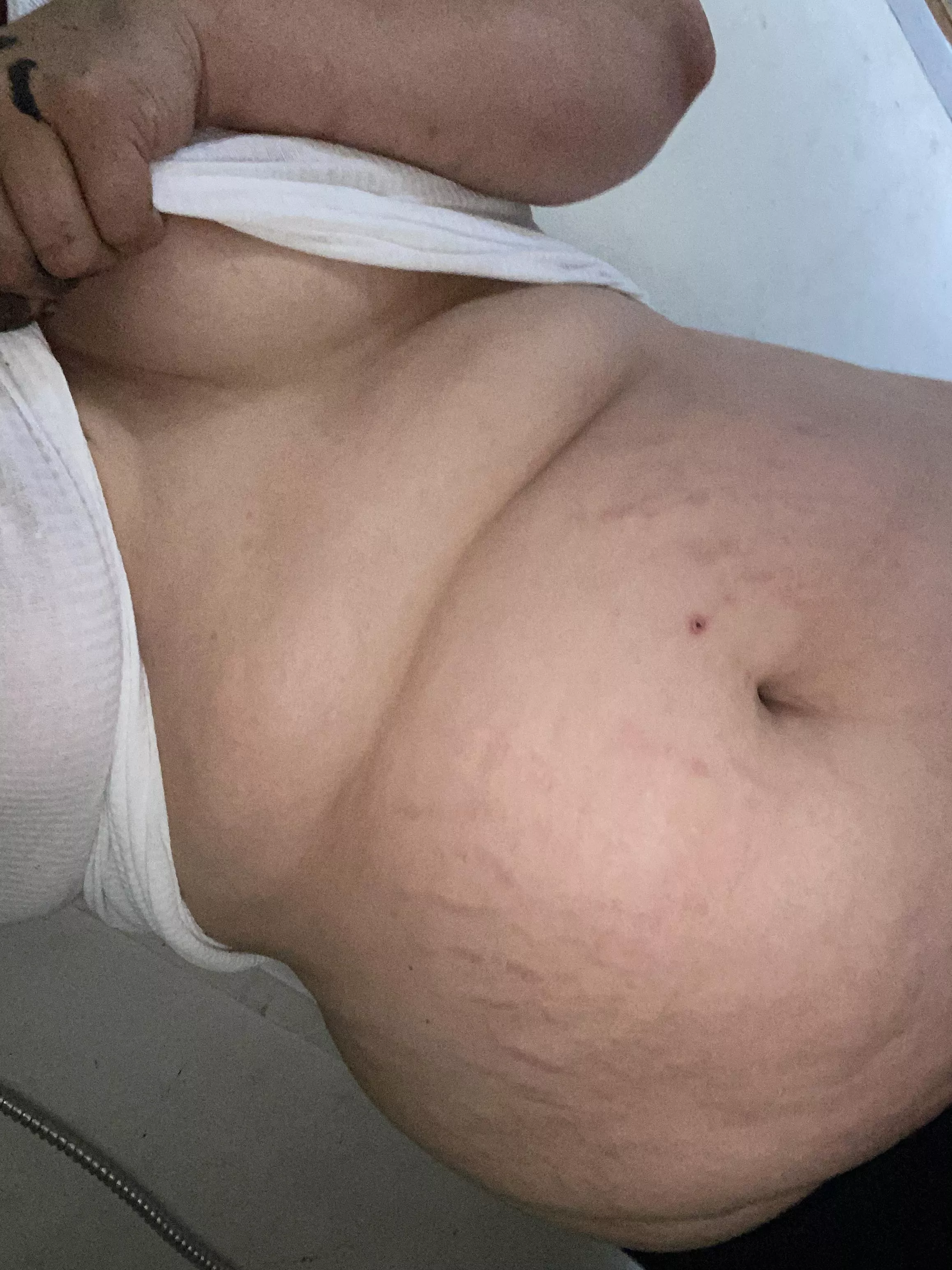 Cute little stretch marks ☺️☺️