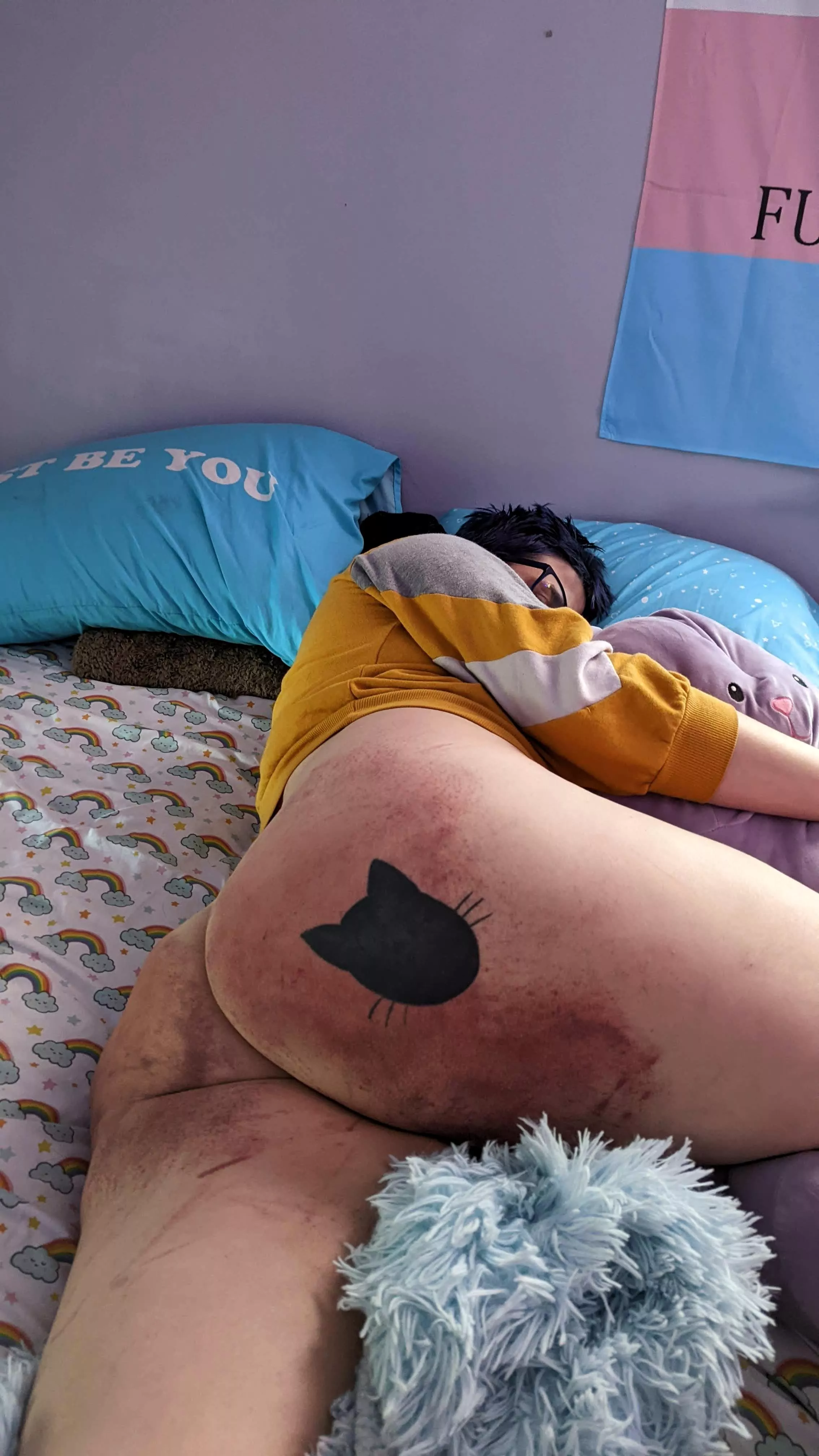 lovely bruising after a very fun session....thanks daddy 😇