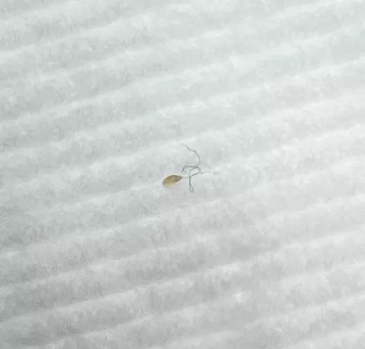 A follicle (?) that came out of my back yesterday!