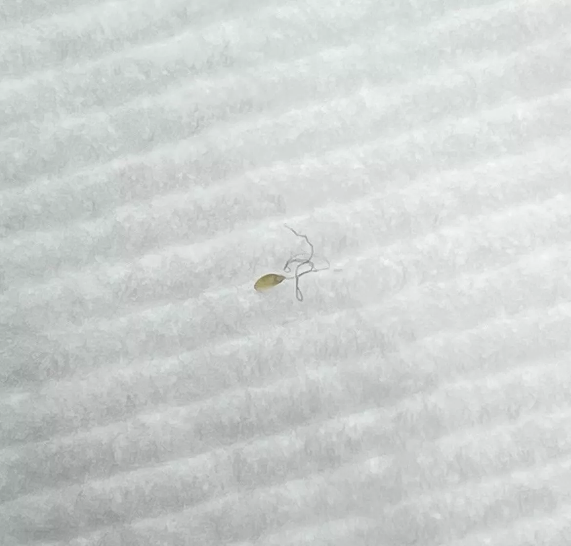 A follicle (?) that came out of my back yesterday!