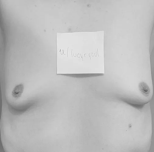 (F) 26, 5’7, 135ish. Still not ready to lose the bra stuffing and admit to the real world how much my boobs have shrunk but my last post made me feel more confident :) (apologies for thé close up Last post got moderated for having a glimpse of clothin