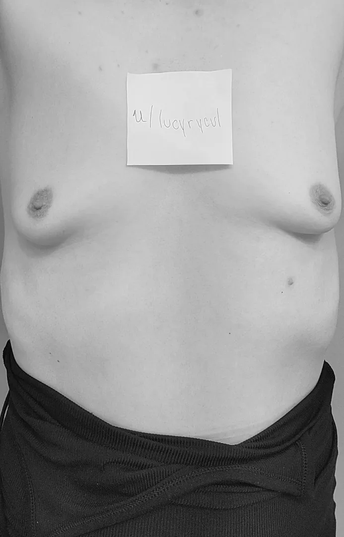 (F) 26, 5’7, 135ish. Still not ready to lose the bra stuffing and admit to the real world how much my boobs have shrunk but my last post made me feel more confident :)