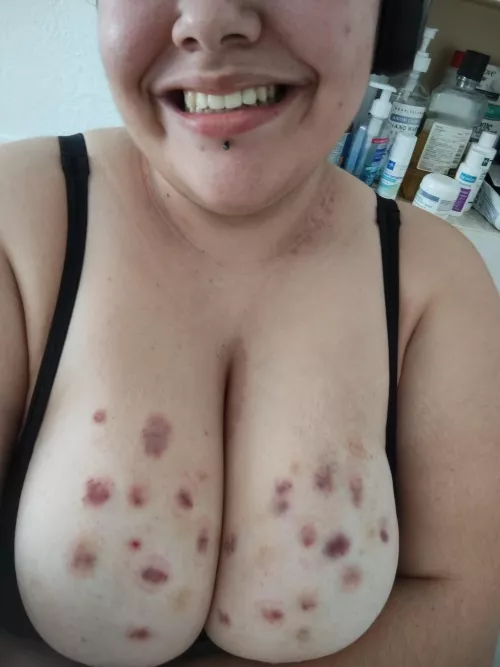 i love the look of fresh hickeys 😌