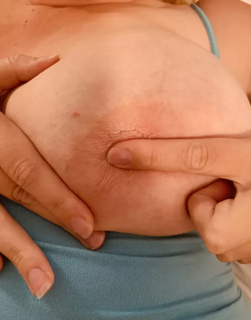 Can you see the bite marks?