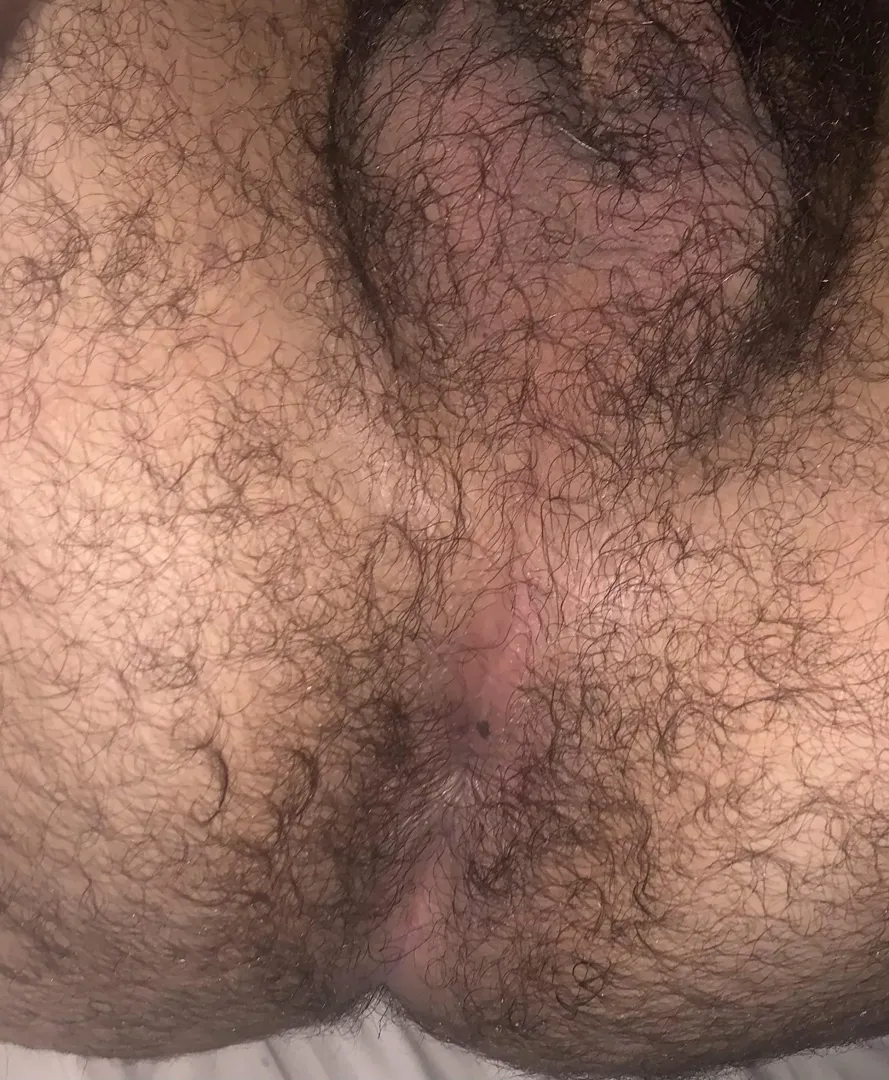 I always feel the need to clarify that I have a birthmark by my butthole lol