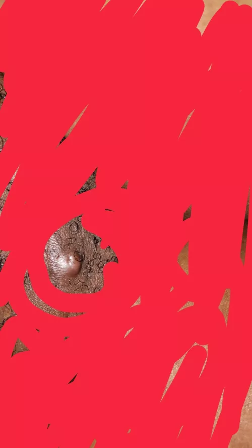 pimple on my pubic mound. ready to pop but is it ready?