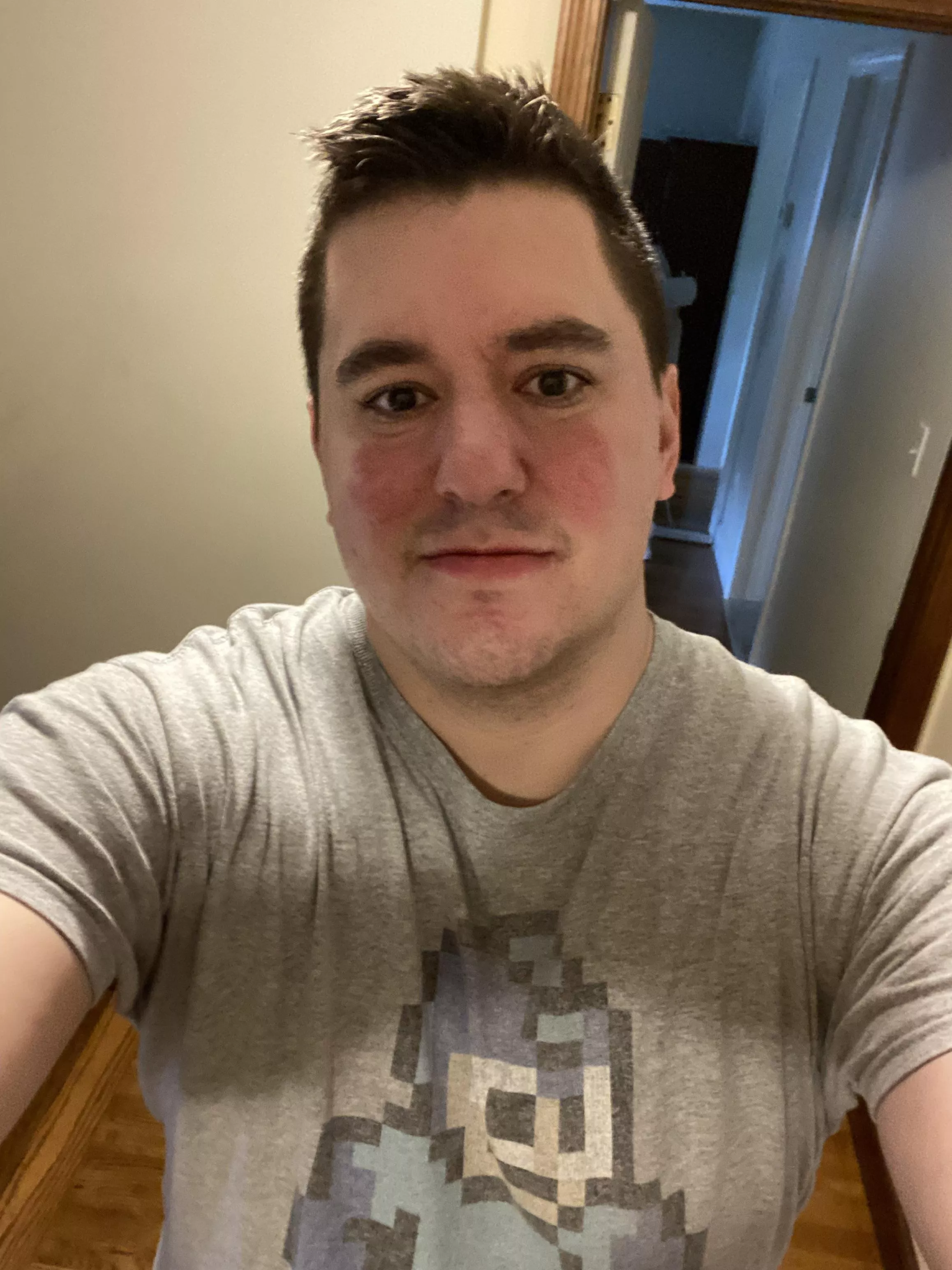 A little self conscious about my rosacea don’t get a lot of tinder matches