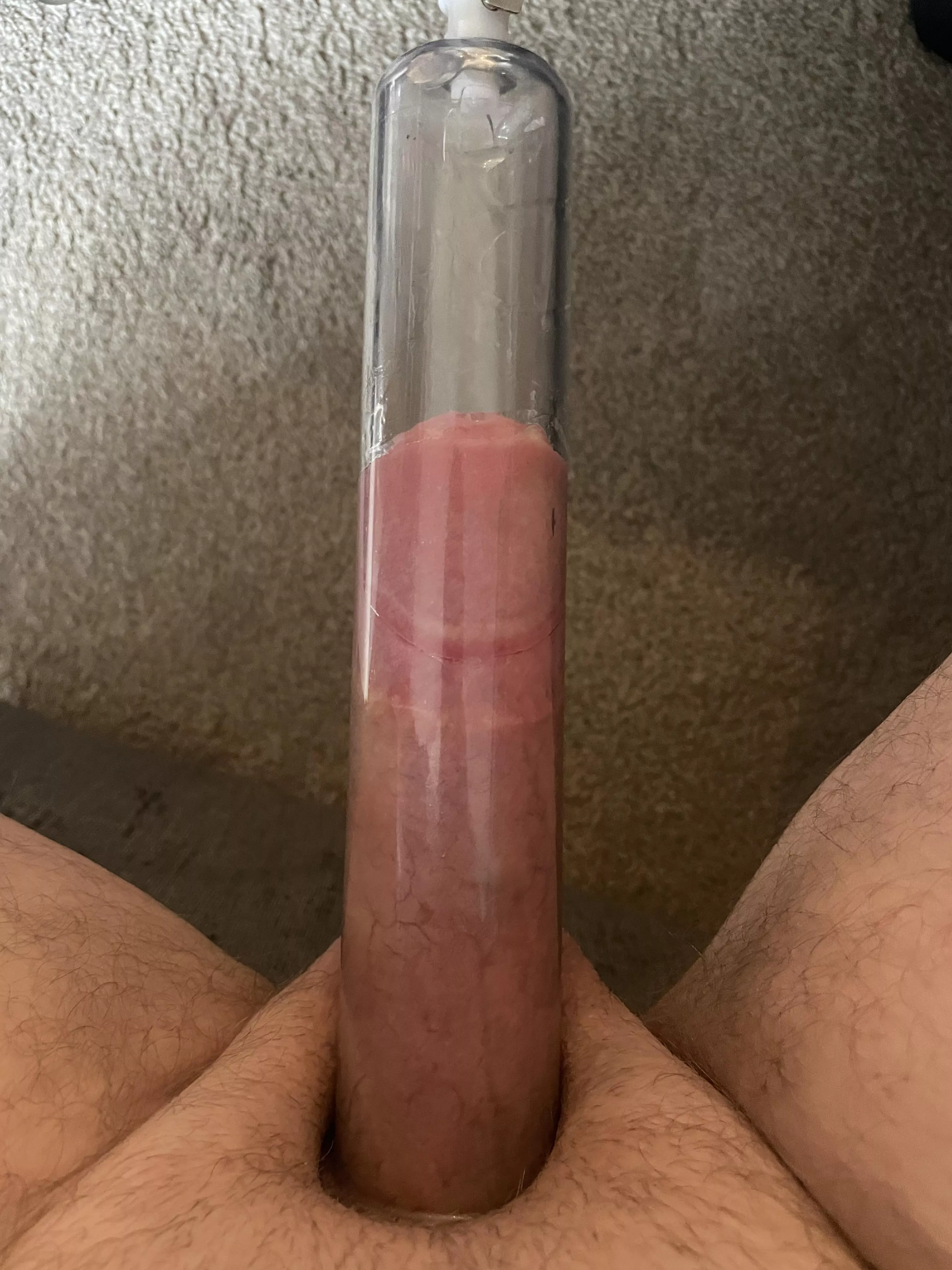 Pumping for length. Any tips? Currently doing two sets of 15 mins at -5inHg in a 1.75” tube. Also have a 2” tube but I read the compression of the smaller tube not allowing the girth expansion helps focus on length gains? Any advice welcome. Thanks a