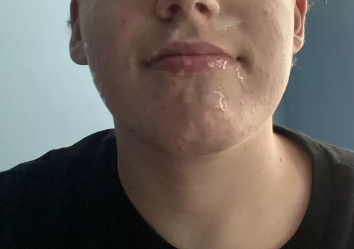 Gave myself a self facial