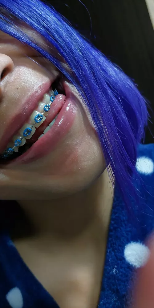 the blue of my braces combines with the white of your milk..😉