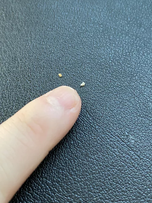 This Little Nugget Came From A Blackhead(?) From “Down There”