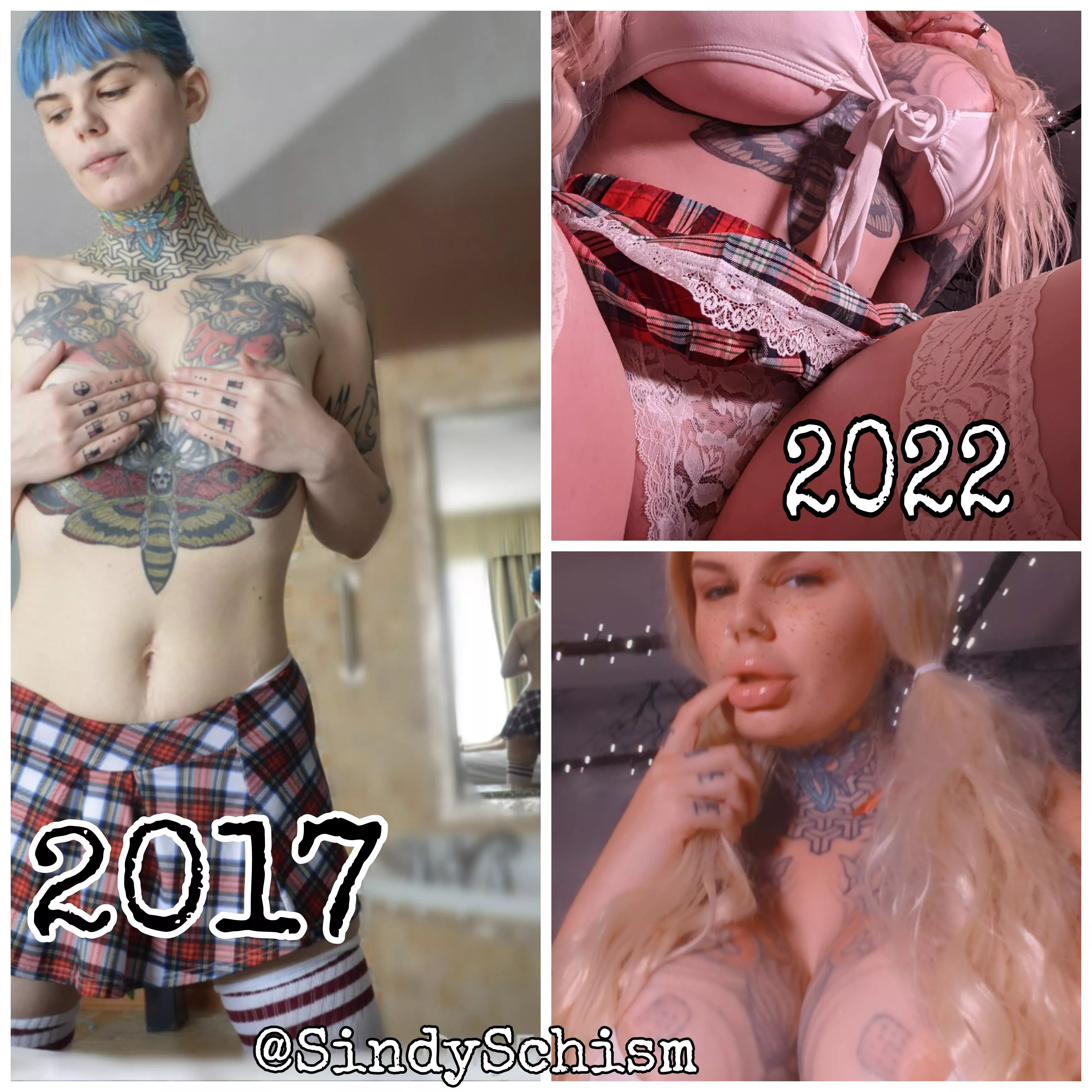 School girl edition: Filler, Botox, pdo threads, 1,100cc implants, bbl, abdominoplasty.