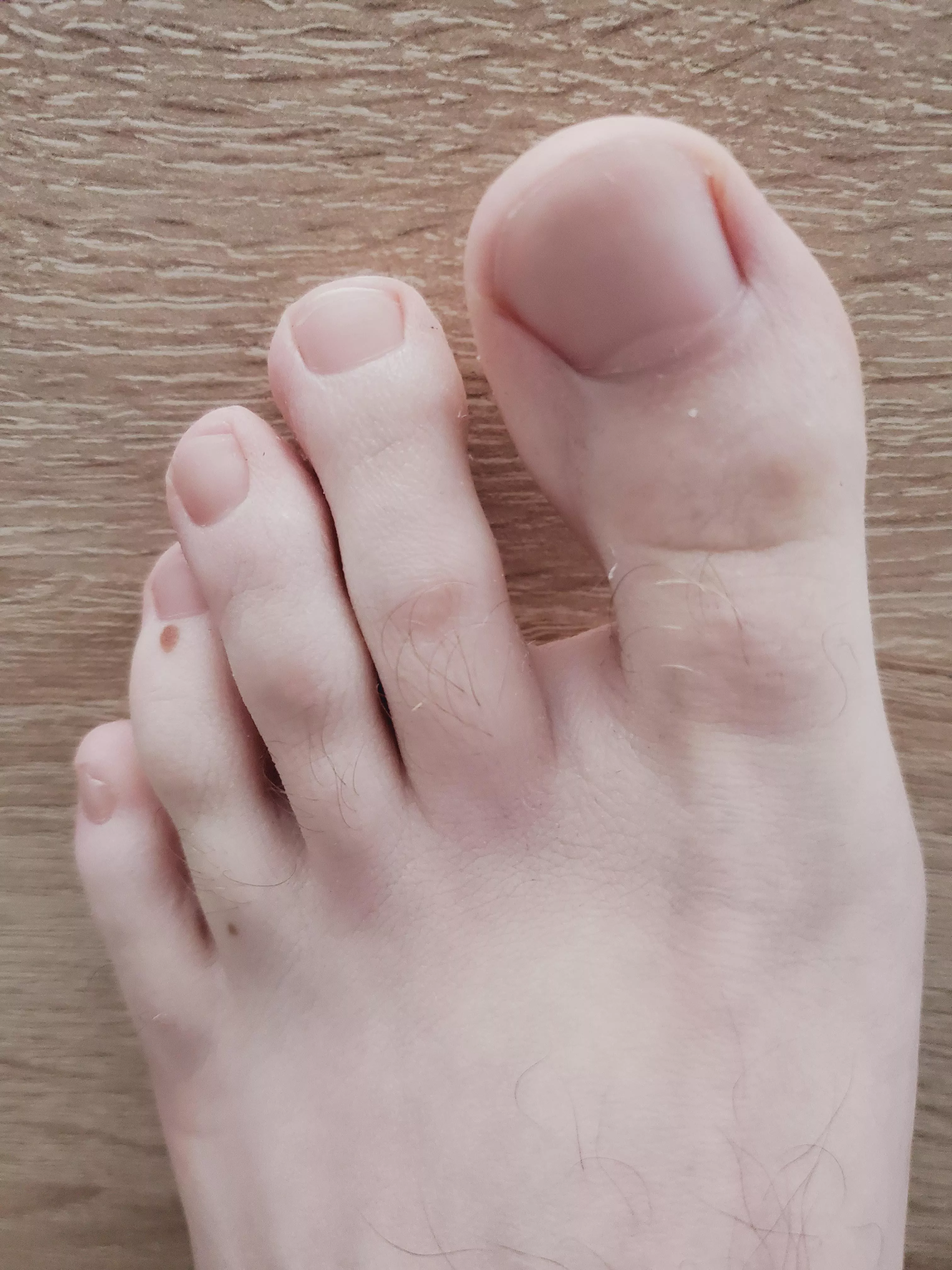 Some people told me that I have pretty toes! What's your thoughts? 😋