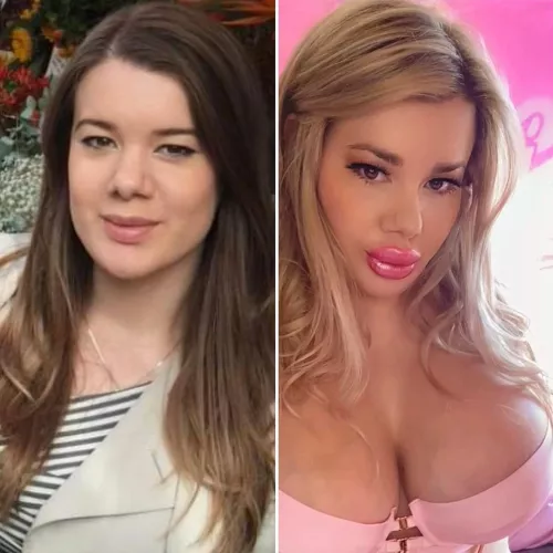 Before & After