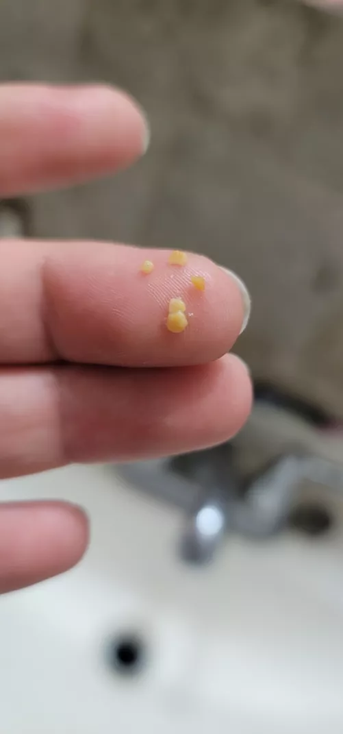 late night digging for gold