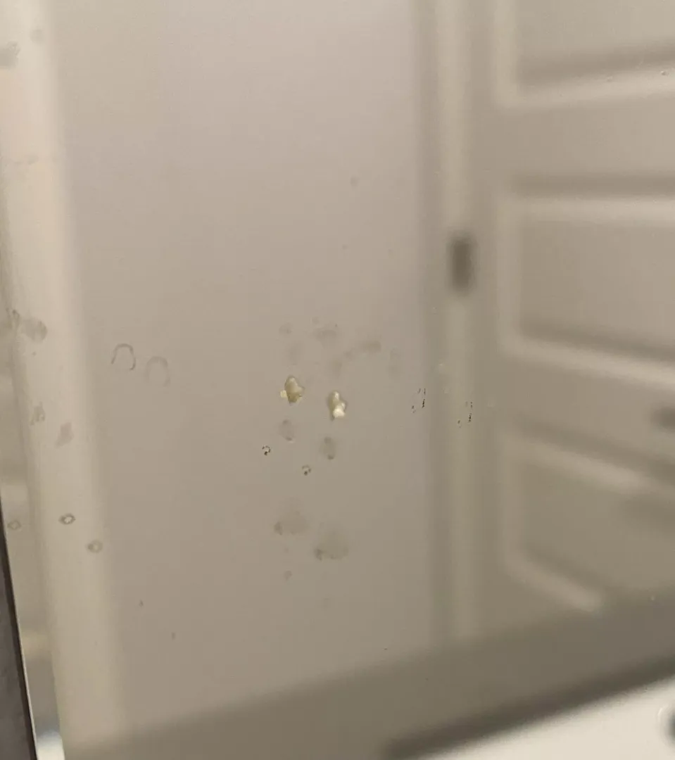 Just Popped A Big, Juicy Zit On My Chin. It Made A Sound As The Contents Splattered On My Bathroom Mirror.