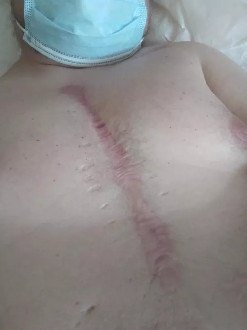 Scar fetish anyone?